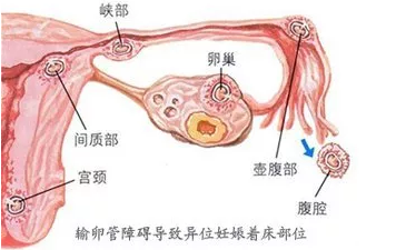 重庆送子鸟医院